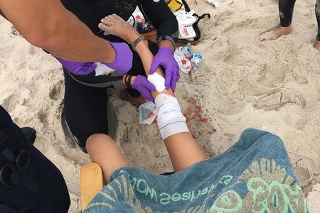 Lola Pollina, 13, following the bite (Courtesy of Barbara Pollina)