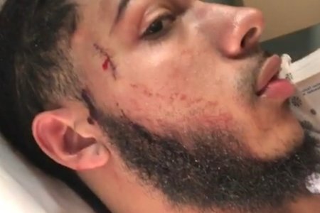 Pedro Hernandez's suffered stab wounds to his face and back in the altercation