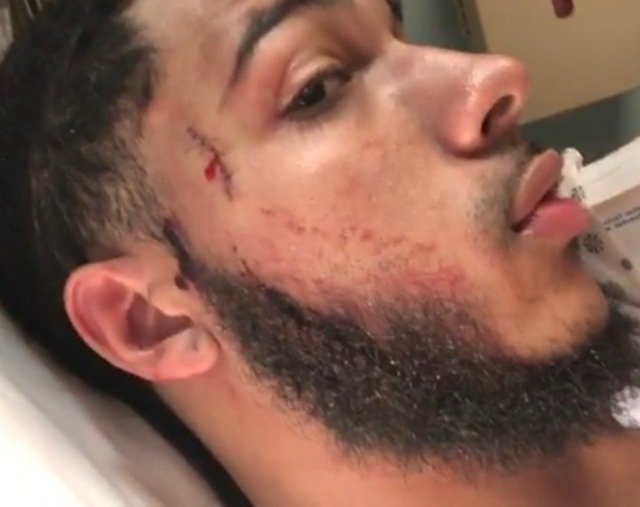 Pedro Hernandez's suffered stab wounds to his face and back in the altercation