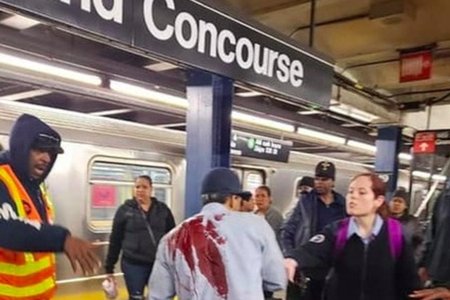 The MTA conductor is now in stable condition, authorities said