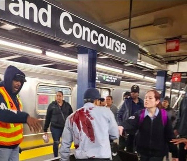 The MTA conductor is now in stable condition, authorities said