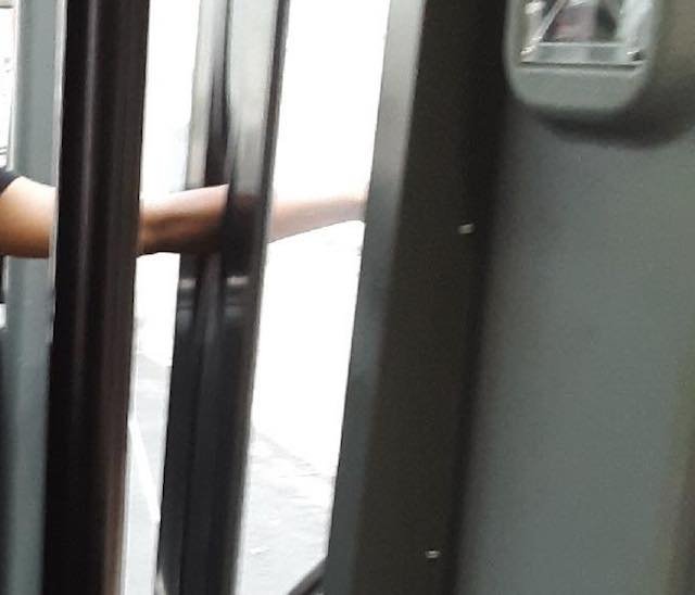 An image of the girl's trapped arm, posted to Facebook by bus passenger Paul Costello.